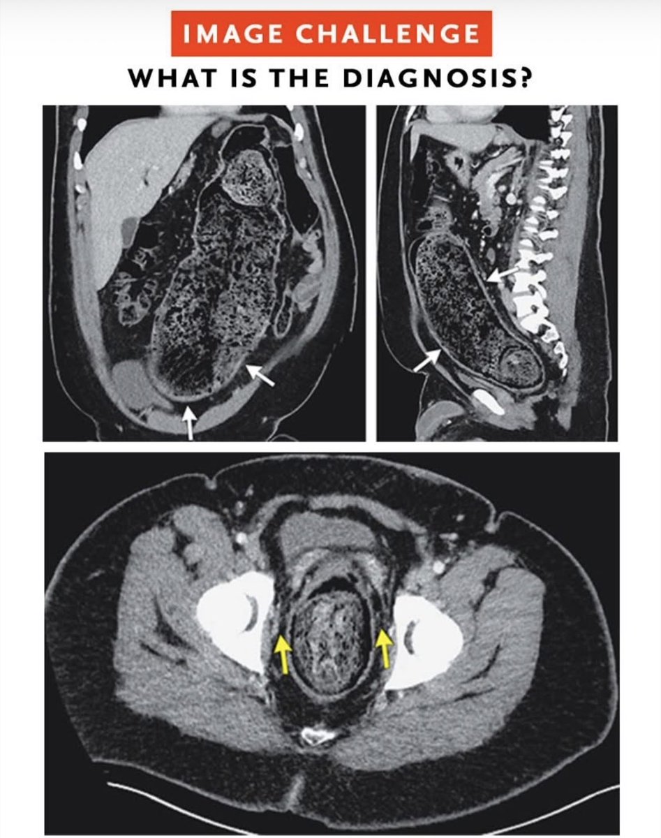Keith Siau tweet media