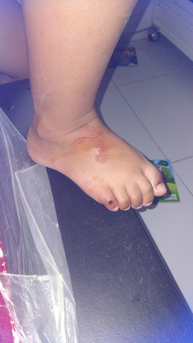 IndrieZoe's tweet photo. Diprank nakes igd . Luka sekecil ini oles betadin 135rb . Krna 2 org jadi 270rb ..... Hahahahah segitunya cari duit kah . https://t.co/79SWYFNq8n