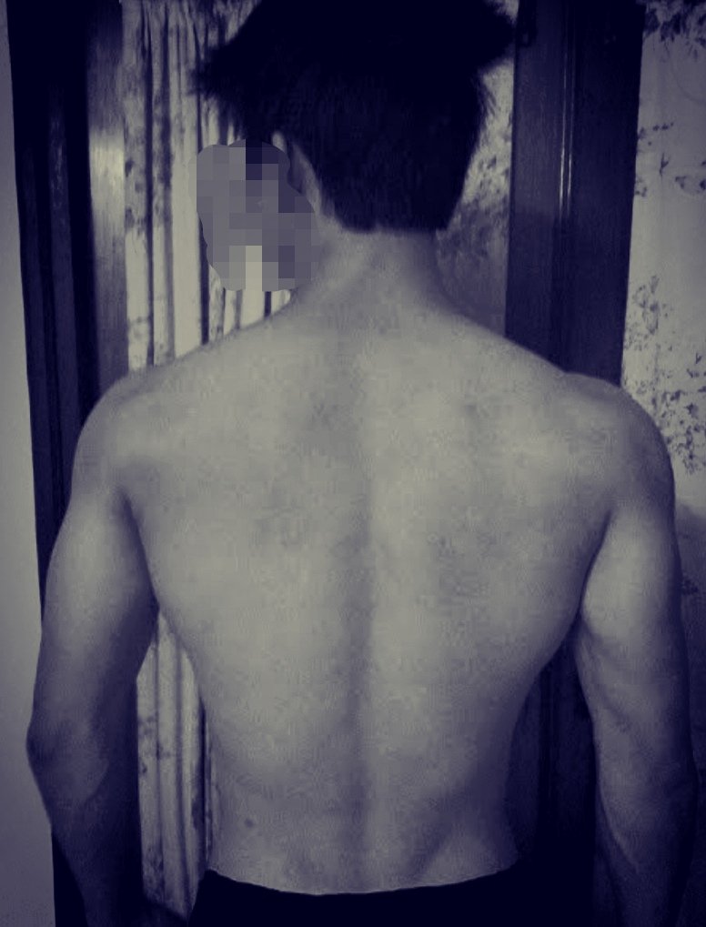 หันหน้าก็อายพุง​ พอหันหลังก็อายสิว😅😅😅