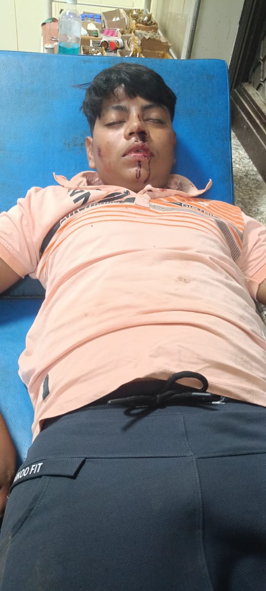 Anil10071990's tweet photo. @Uppolice @unnaopolice
महोदय मामला बीघापुर थाना क्षेत्र का हैं दबंगों ने प्रार्थी को बेरहमी से मारा पीटा और जातिसूचक गालियां दी यहां तक दबंगों ने कट्टा लेकर मारने के लिए भी दौड़ाया, लेकिन अभी तक प्रार्थी की कोई भी सुनवाई नहीं हुई, कृपया मामले दर्ज कर उचित कार्यवाही करने की कृपा करें!

#WWECrownJewel #GoaEmpowersHer #LoveForMonster