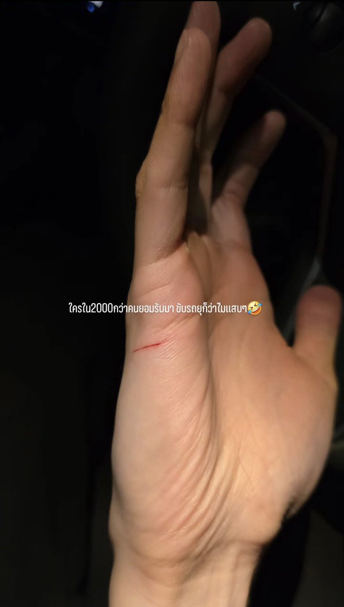ใครใน 2000กว่าคนยอมรับมา ขับรถยุก็ว่าไมแสบๆ🤣

IGs:yinyin_anw
#ดอกนีออนรอรักมื้อแรก
YINWAR CONCERT DAY1 
#yinyin_anw Yin Anan <a href="/yinyin_anw/">Yinyin</a> #หยิ่นวอร์