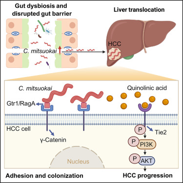 Catenibacterium mitsuokai promotes hepatocellular carcinogenesis by binding to hepatocytes and generating quinolinic acid dlvr.it/TNcc8h