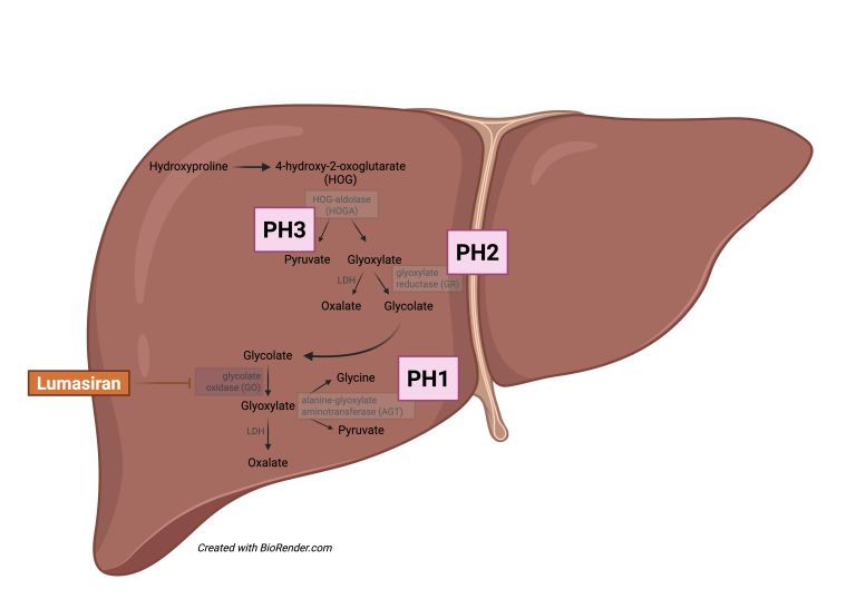 NEW Commentary by <a href="/Nephro_Sparks/">Matthew Sparks, MD</a> and <a href="/AleTomasiMD/">Alessandra Tomasi</a>: 

Silencing Primary Hyperoxaluria with Lumasiran: Two Year Follow-up of the Phase 3 ILLUMINATE-C Trial

bit.ly/47crprj 

Article by Anne-Laure Sellier-Leclerc et al. bit.ly/3WuEvtO <a href="/lieske_john/">John Lieske MD</a>