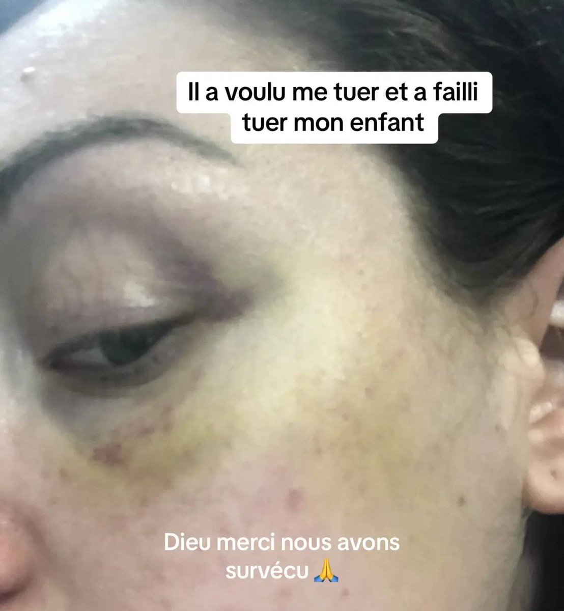 EdithDumontt's tweet image. J ai vécu le même pendant 15 ans et sa fait 3 ans que suis parti et suis enfin heureuse courage a toi.
#expérience
#Violence