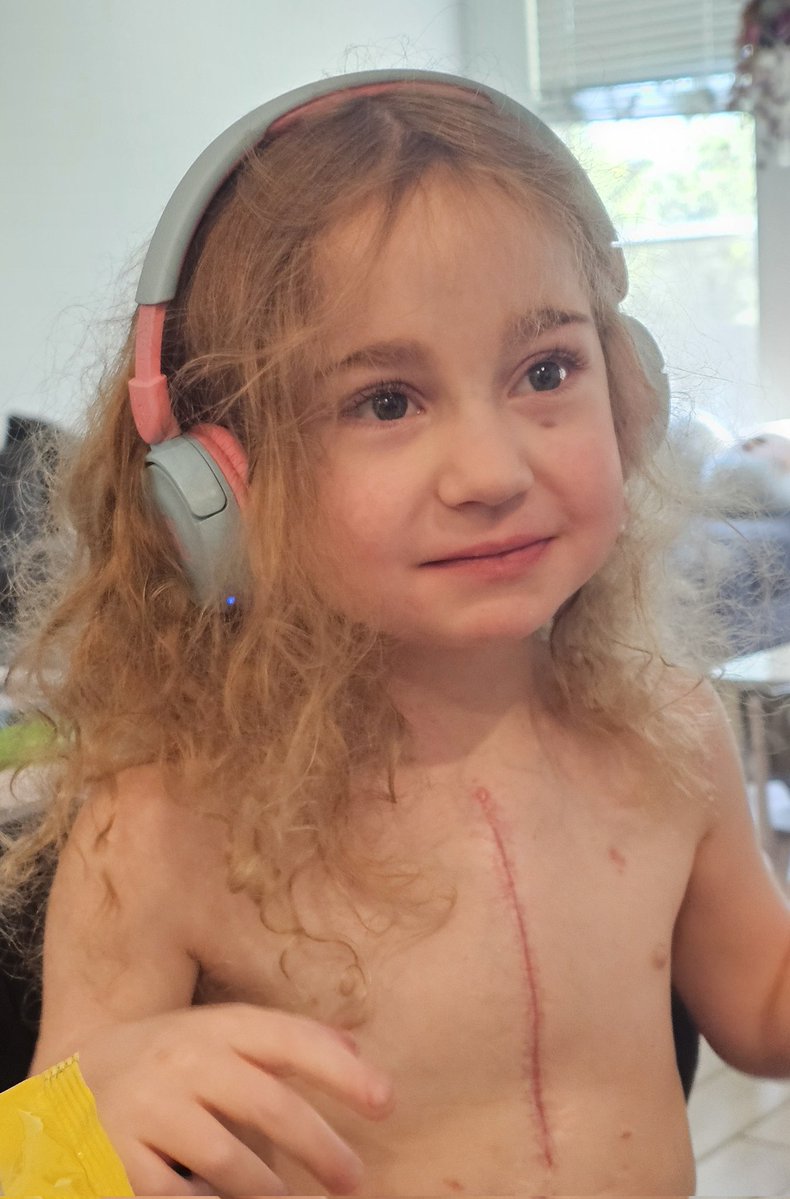noCinErik's tweet image. We just received the results from Evelyn&apos;s heart biopsy. It looks like she is in rejection. Fortunately, it&apos;s still treatable, but it looks like we&apos;re not out of the woods. Going to go touch grass now.