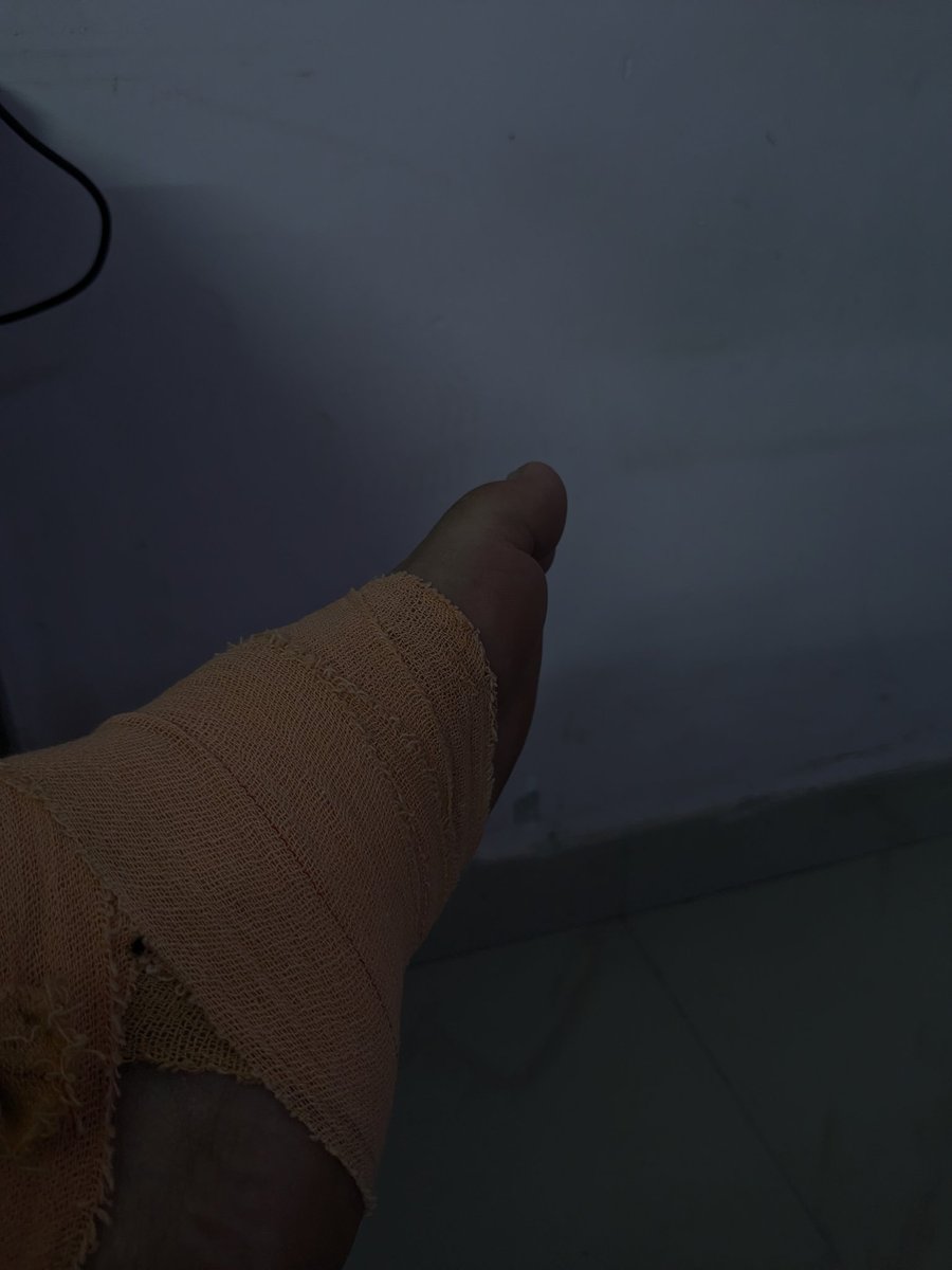 codeslayerTanj's tweet image. Life update : It hurts!
#tanjiro