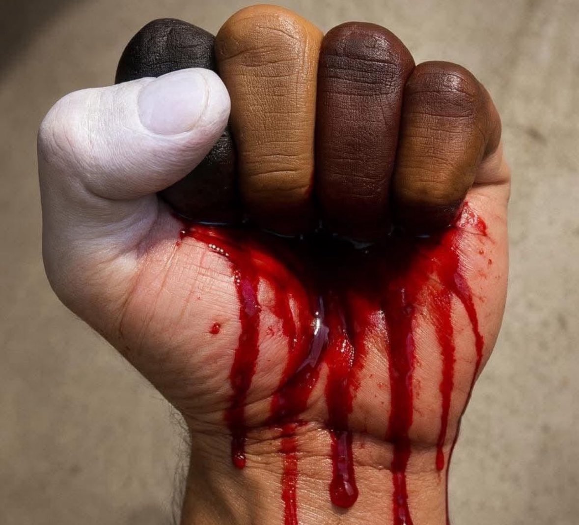 🚩Why do we continue to treat racism as the paramount issue of our time? 

While it's undeniable that racial differences exist, imagine a world without racism — we would still be confronted by our own prejudices, preferences, and divisions. 

⏩ There is a bigger picture here,