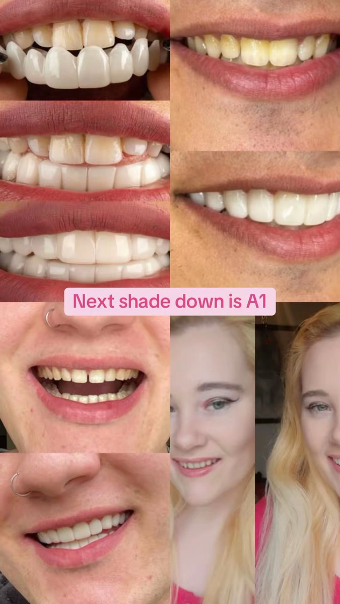 secretveneers's tweet photo. Shades explained! #secretveneers #teeth #clipinveneers #veneersuk https://t.co/9sbGCcDmvg
