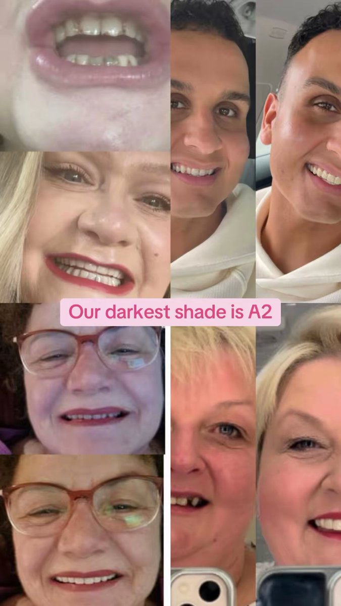 secretveneers's tweet photo. Shades explained! #secretveneers #teeth #clipinveneers #veneersuk https://t.co/9sbGCcDmvg