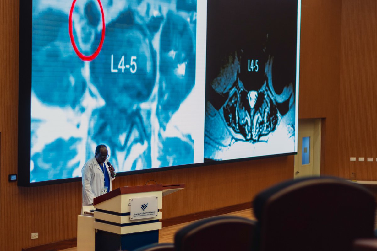 Spine_iau's tweet photo. 🦴🔍 Dr. Ahmed Abdulfattah presents XLIF/DLIF, highlighting the lateral approach to lumbar interbody fusion, focusing on anatomical corridors, surgical technique, and clinical outcomes. A must-know for modern spine surgery. https://t.co/x4pl4Us1Fk