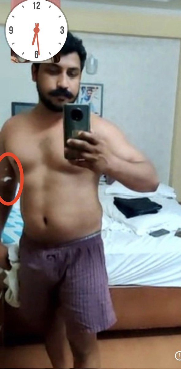 WBirla's tweet image. इस बीजेपी की एजेंट महिला को कोई एडिटिंग

सिखाओ बताओ PHD करके भी यही हाल है! 
महिला होने का गलत फायदा मत उठा
शोषण तो एक बहाना था असल तो राजनिति
मै आना था 

ऐसे फ़र्ज़ी एडिट कर कोन न्याय मांगता है! 
हर लड़की तेरी तरफ नीच हो गयी तो
युवाओं का मरना पड़ेगा! #bheemarmy