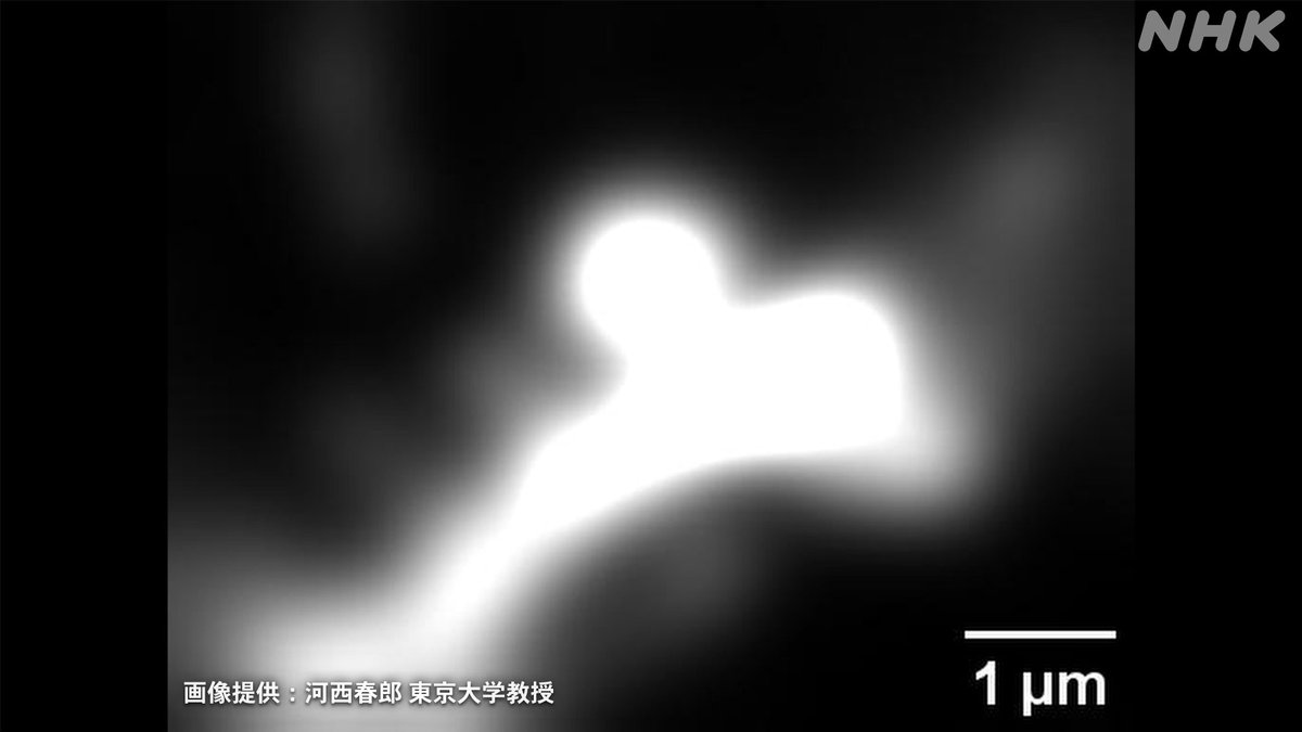 nhk_sciencezero's tweet image. 衝撃！
日本人研究者が世界で初めて記憶ができる瞬間を捉えました！

脳内にあるものがプクッと…
記憶ができる瞬間です！

#サイエンスZERO
📺放送は日曜 夜11:30～
web.nhk/tv/an/zero/pl/…

x.com/nhk_sciencezer…