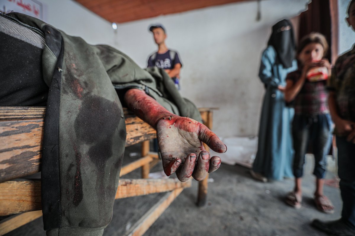 ⚫️İsrail’in Gazze Şeridi’ne saldırıları sonucu son 24 saatte 66 kişinin hayatını kaybetmesi ve kayıp-ihbar dosyasındaki incelemelerin ardından 298 kişinin daha yaşamını yitirdiğinin belirlenmesiyle toplam can kaybı 67 bin 74’e yükseldi