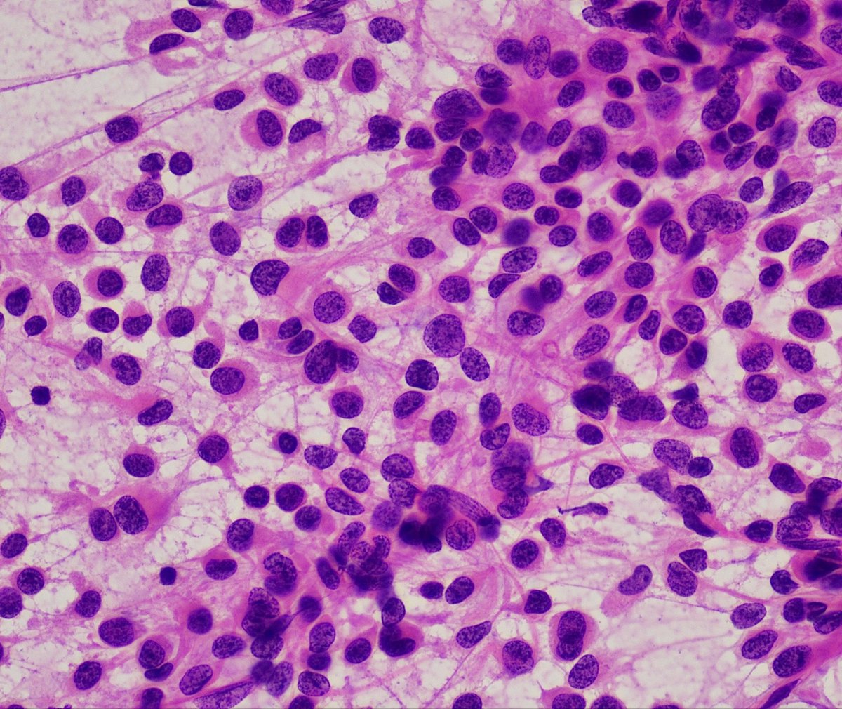 Saeed Asiry MD, FIAC tweet media