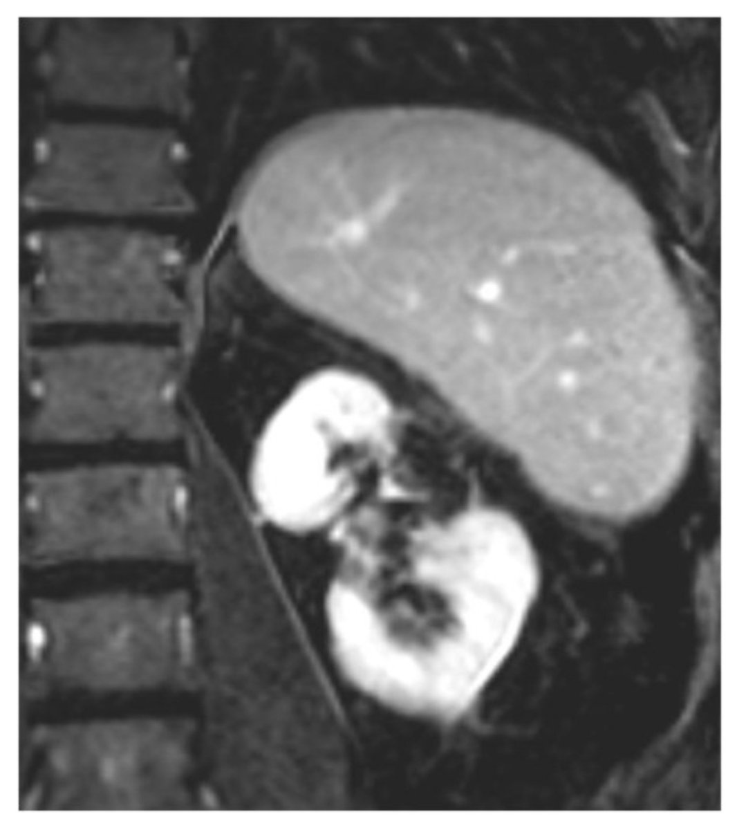 Beau Bosko Toskich, MD FSIR tweet media