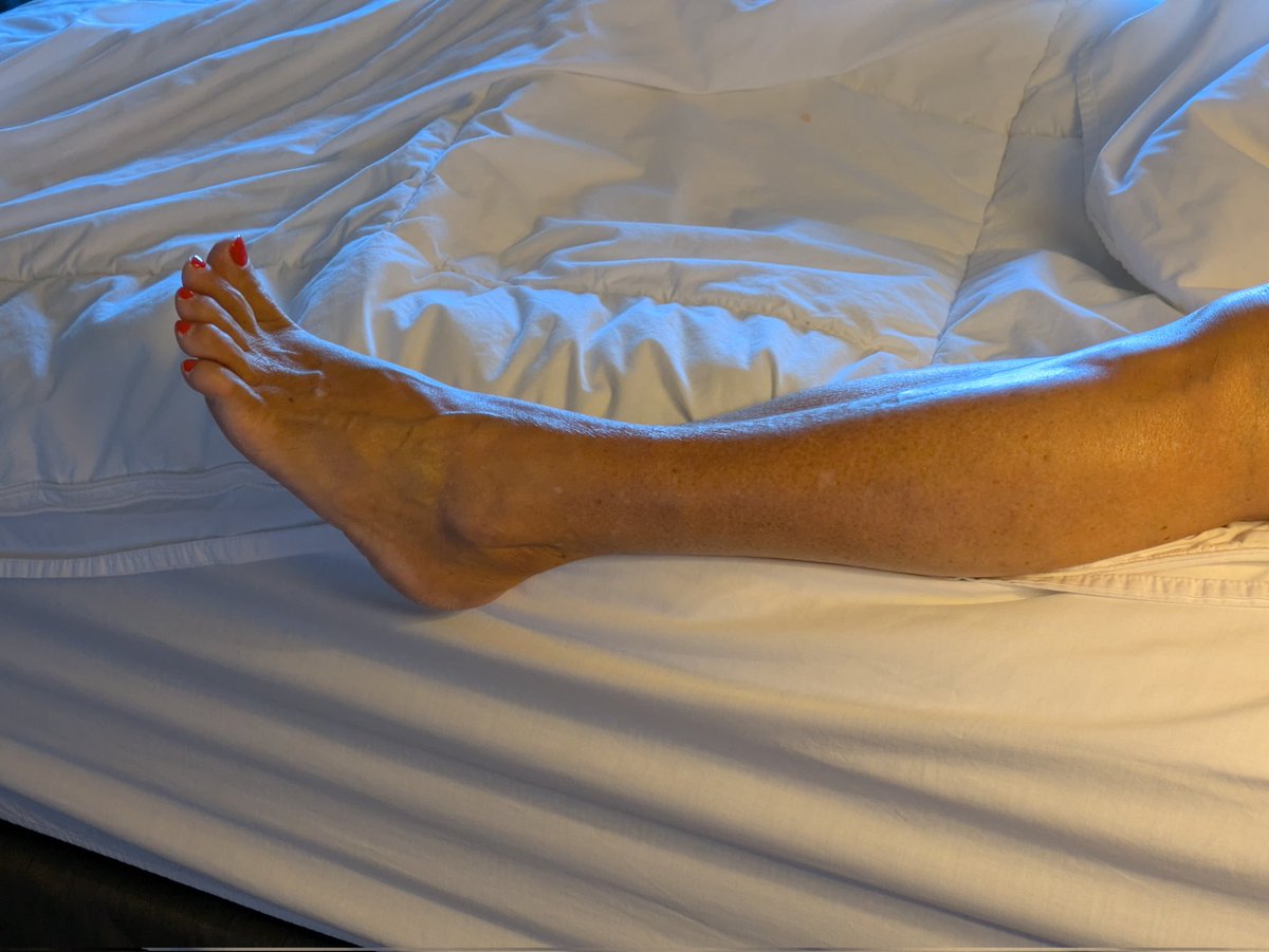 FappingFeet's tweet image. Hotel leg and foot. A study in sensuality.