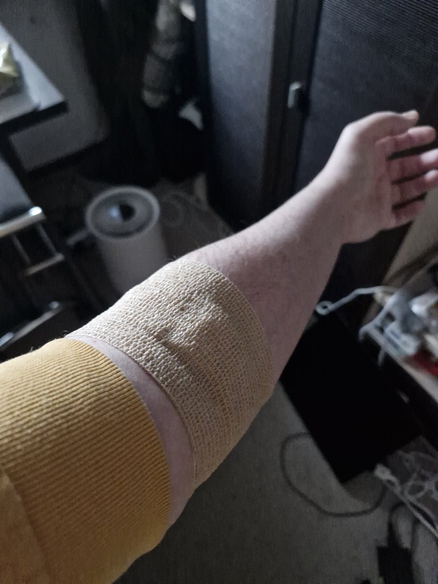 Been busy this day. I hope for the last doc visit and be free.
Hand is fine :3