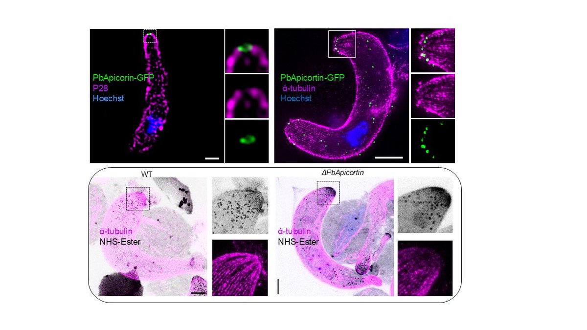 Zeeshan (@zeeshan_mf) on Twitter photo Our new findings on Plasmodium Apicortin that is restricted to invasive stages within mosquitos. <a href="/RitaTewari/">Rita Tewari</a> , Thanks to our collaborators Carolyn Moore and Tony Holder. biorxiv.org/content/10.110… Our new findings on Plasmodium Apicortin that is restricted to invasive stages within mosquitos. <a href="/RitaTewari/">Rita Tewari</a> , Thanks to our collaborators Carolyn Moore and Tony Holder. biorxiv.org/content/10.110…