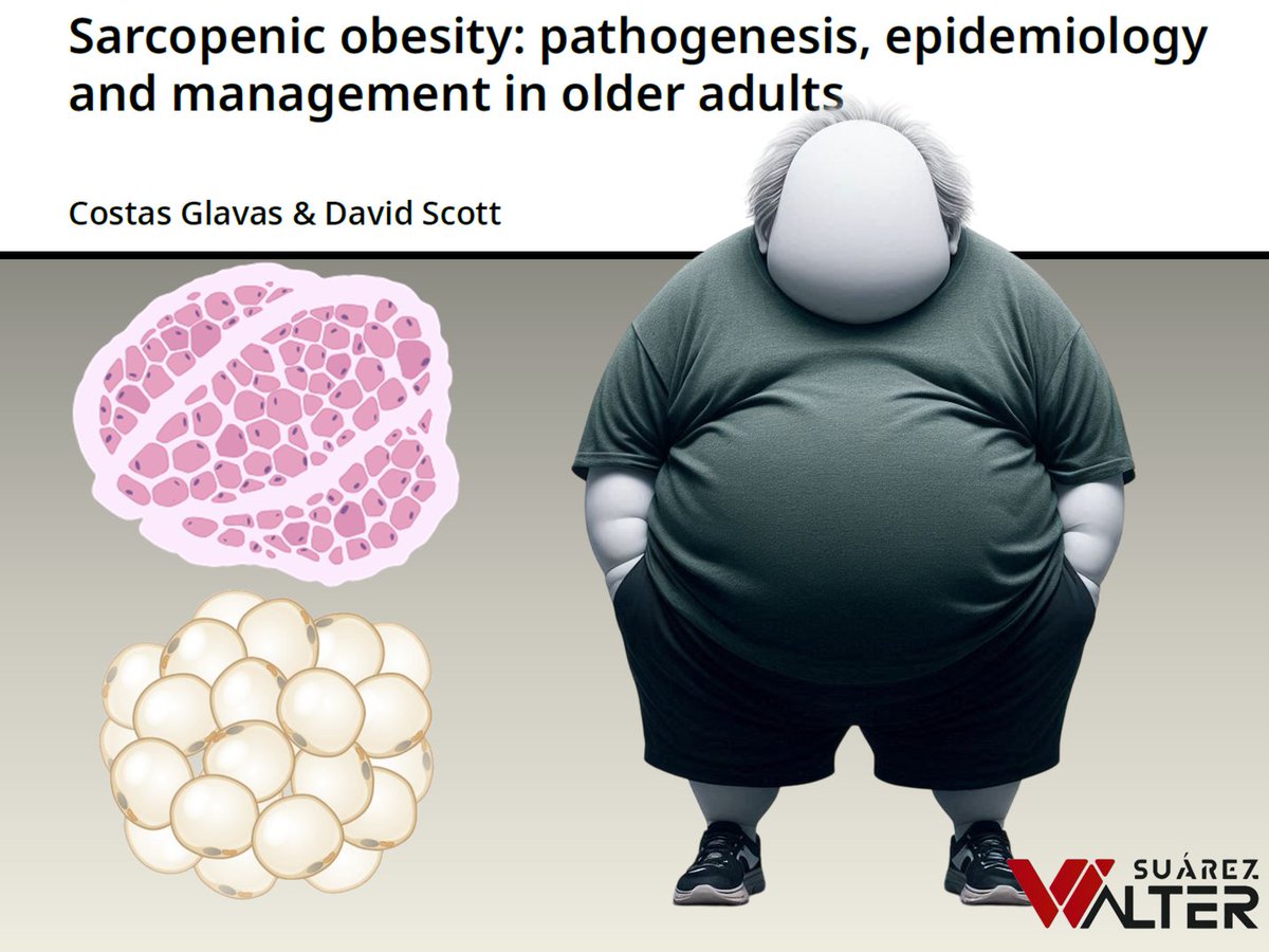 OBESIDAD SARCOPÉNICA

¡¡¡A leer, zagales!!!

waltersport.com/investigacione…