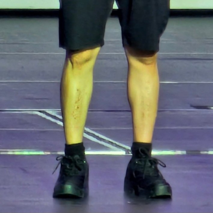 pearlaquapanda_'s tweet photo. "Why do you have so many scars on your shin?" :(((

251004 SS10 in Manila
#KYUHYUN #규현 #SUPERJUNIOR #슈퍼주니어 #SS10 #슈퍼쇼10 https://t.co/M7z6QaNIH3