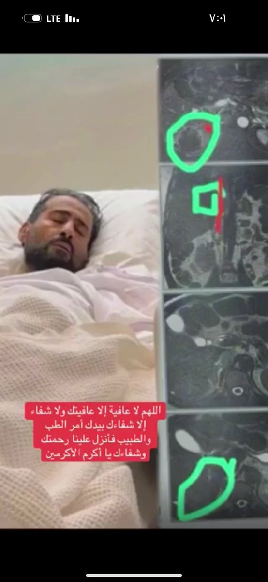 اولا يجب ان يسافر ويجب ان يحول الطبيب الذي قطع شرايينه إلى التحقيق الشعب ليس تحارب فيران لبعض الاطباء الوافدين المفروض يحاسب وزير الصحة كذالك #بدر_المطيري