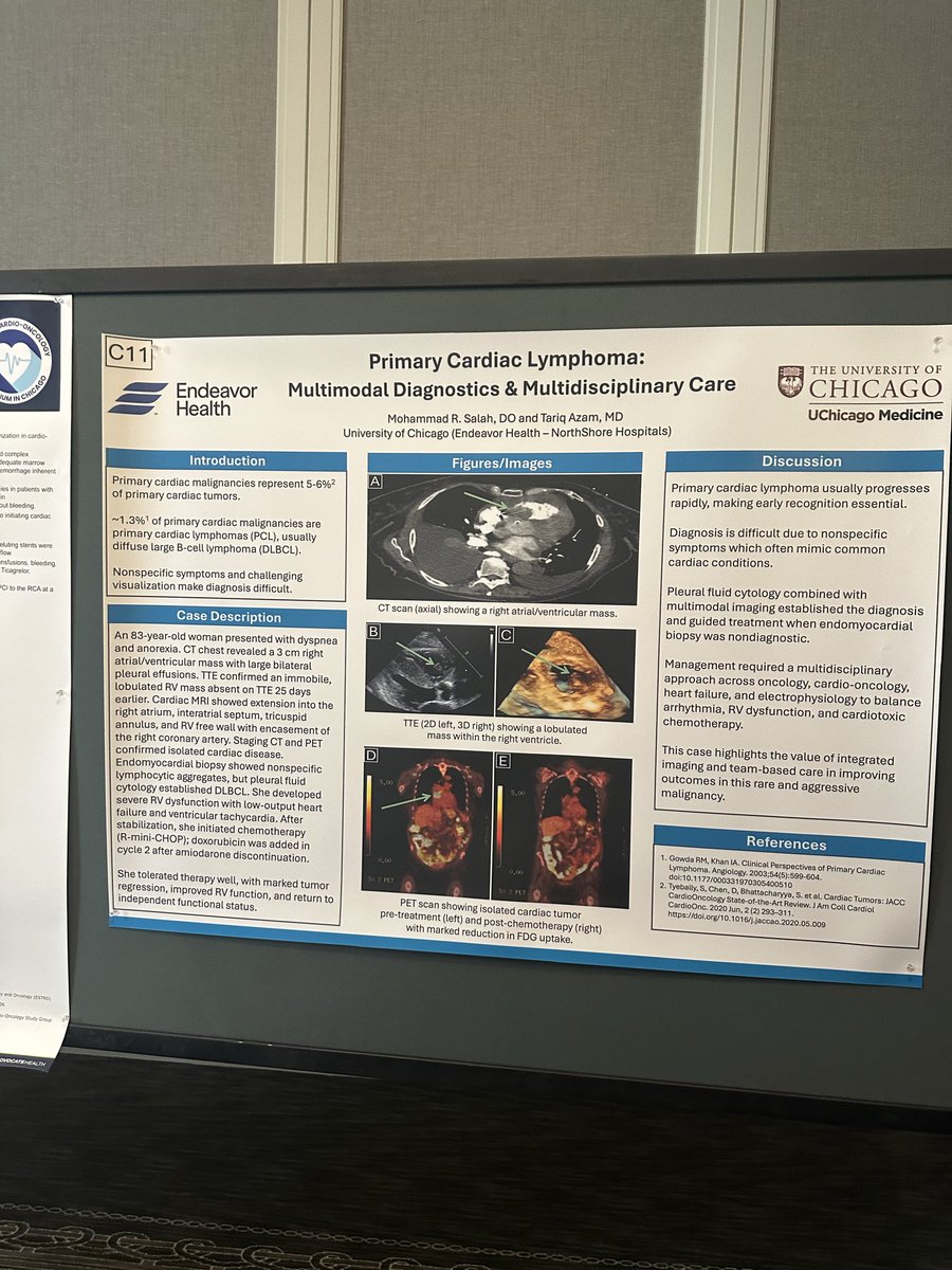InkedHeartDoc's tweet image. Great to meet such a great cardio-onc group during the regional Cardio-onc symposium on current paradigms in CV care of cancer patients and survivors
#cardiotwitter #CardioOnc