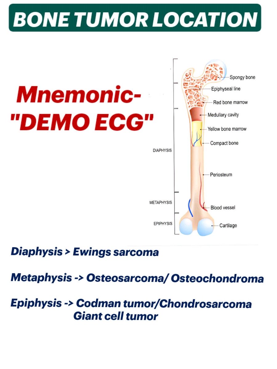 PerceptioApp's tweet photo. Giant Cell Tumor (Osteoclastoma)

Benign but locally aggressive tumor

Seen in young adults (20–40 yrs) → often female

Arises from epiphysis of long bones → may extend to metaphysis

X-ray → ���soap-bubble” lytic lesion, eccentric & expansile

May be incidental or present with pain, swelling, ↓ joint motion

Treatment → curettage + bone graft/cement → denosumab or resection if recurrent

Risk → can recur or rarely transform malignantly
