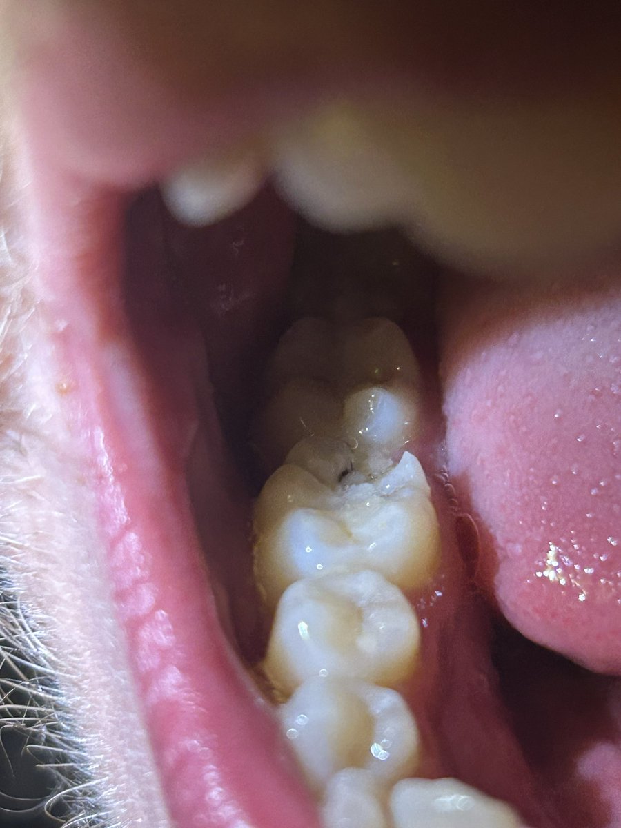 satansket's tweet photo. @McDonaldsUK my bf just broke his tooth on a CHICKEN SELECT sort it out https://t.co/fE4DWTQkNq