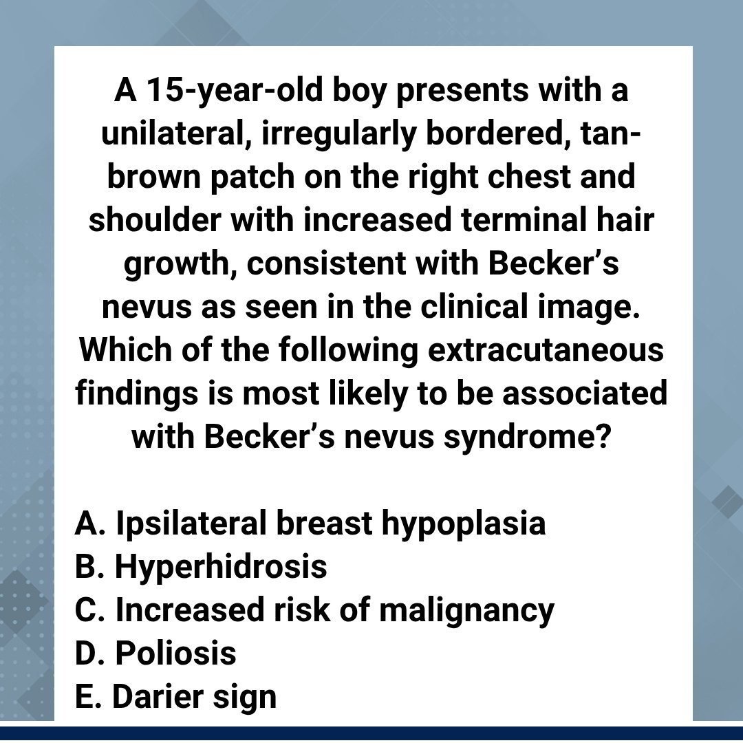 Friday Pop Quiz — late but live! Pick A/B/C/D/E and drop your answer below ⬇️. 

See the correct answer + explanations on Next Steps in Derm: ow.ly/yBca50X6Fl1

 #FridayPopQuiz #DermQuiz #NextStepsInDerm