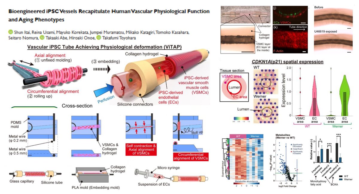 HaoYin20's tweet image. #WernerSyndrome
hiPSC-derived engineered vessel

#SpatialTranscriptomics #Visium @10xGenomics + #Metabolomics▶️
#BranchedChainKetoAcid⬇️
 #MonohydroxyFattyAcid⬆️
in Werner vessels with traits of #PrematureAging

Aligned #SmoothMuscleCell in Collagen hydrogel➡️
Roll-up around φ…
