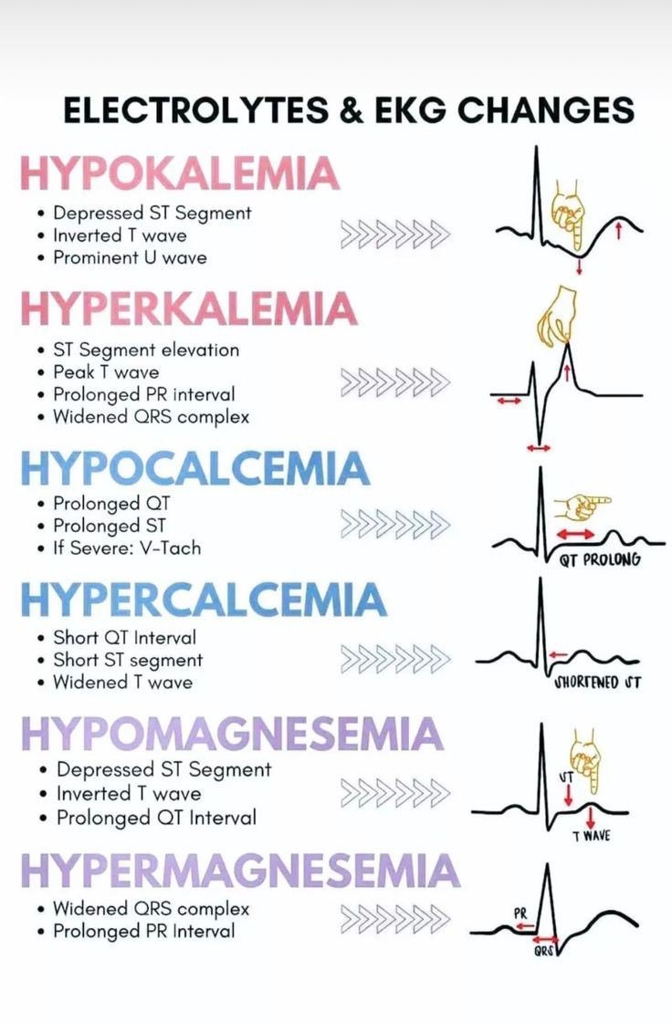 للامانة مافيه اجمل من كذا ملخص 
عن ال ECG 

احفظه عندك