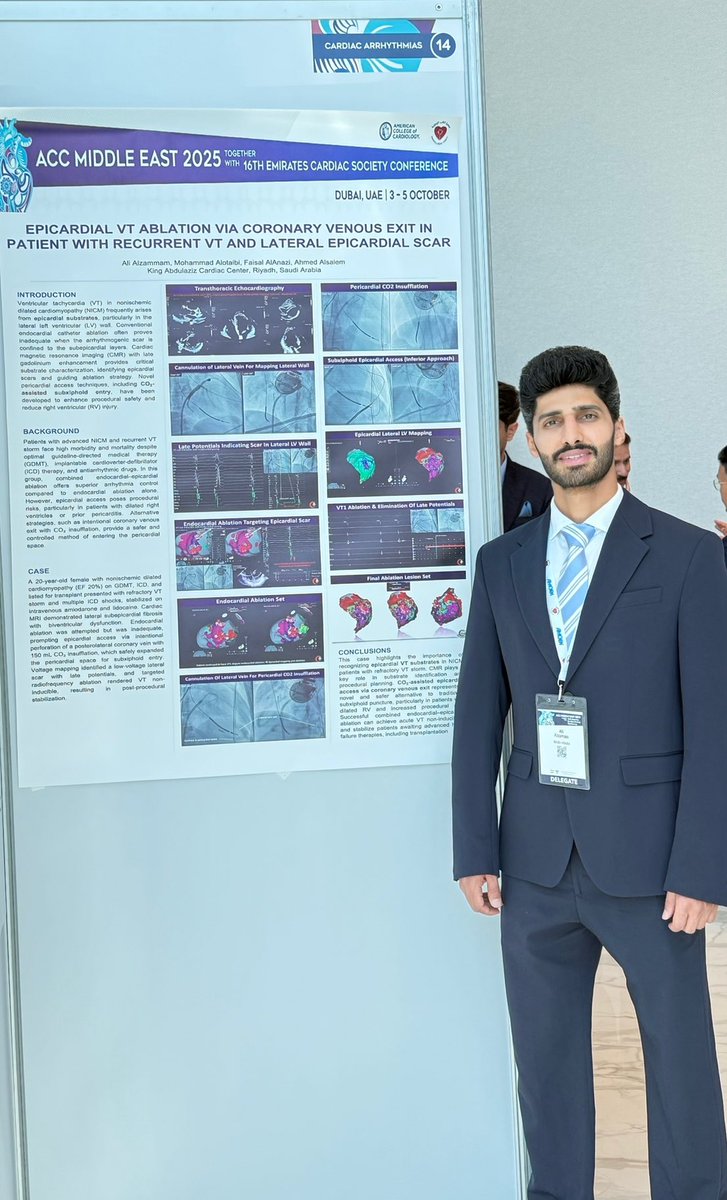 DrAlzammam's tweet photo. Today I’m grateful to have participated in #ACCMidEast 2025, presenting a challenging case of epicardial VT ablation via coronary venous exit in a patient with recurrent VT and lateral epicardial scar. https://t.co/VIujoUXo9L