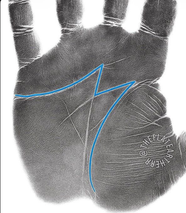 Be honest . Do you see this on your hands?