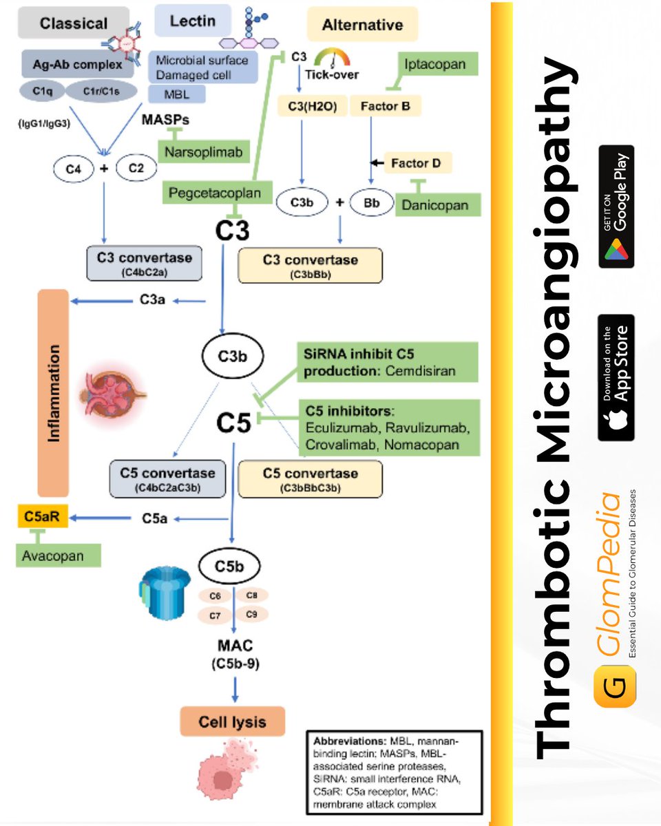 GlomCon's tweet image. NEW Chapter 👉Thrombotic Microangiopathy by Dr. Nattawat Klomjit, Dr. Paolo So, Dr. Jean Hou, Dr. Anuja Java
Access the chapter here:
bit.ly/ThromboticMicr…
@nikkonephro @JeanHouMD @anuja_java
#GlomPedia
#GlomCon
