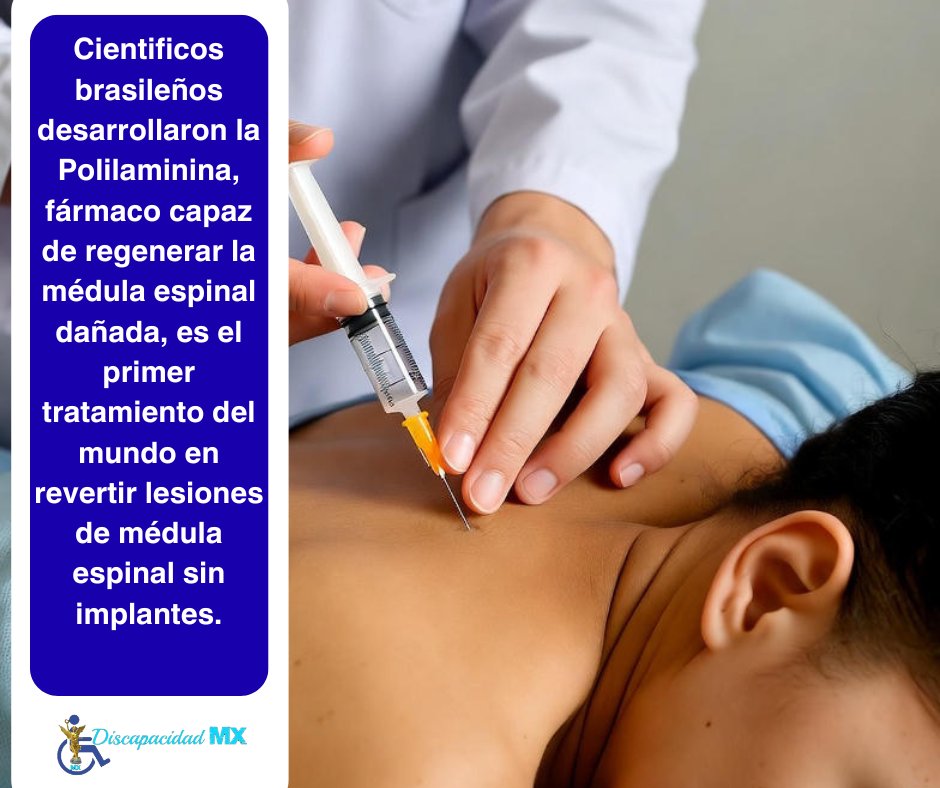 Cientificos brasileños desarrollaron la Polilaminina, fármaco capaz de regenerar la médula espinal dañada, es el primer tratamiento del mundo en revertir lesiones de médula espinal sin implantes.
facebook.com/share/p/1DRz8T…

#DiscapacidadMx #AvancesMedicos #MedulaEspinal
