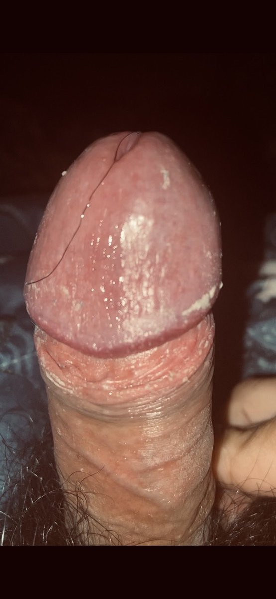 JJJASonnye's tweet photo. Càng hôi càng nứng 🧀🧀🧀 #smegma #cacbua #mancum #stinkdick https://t.co/s0ylYs1aA4