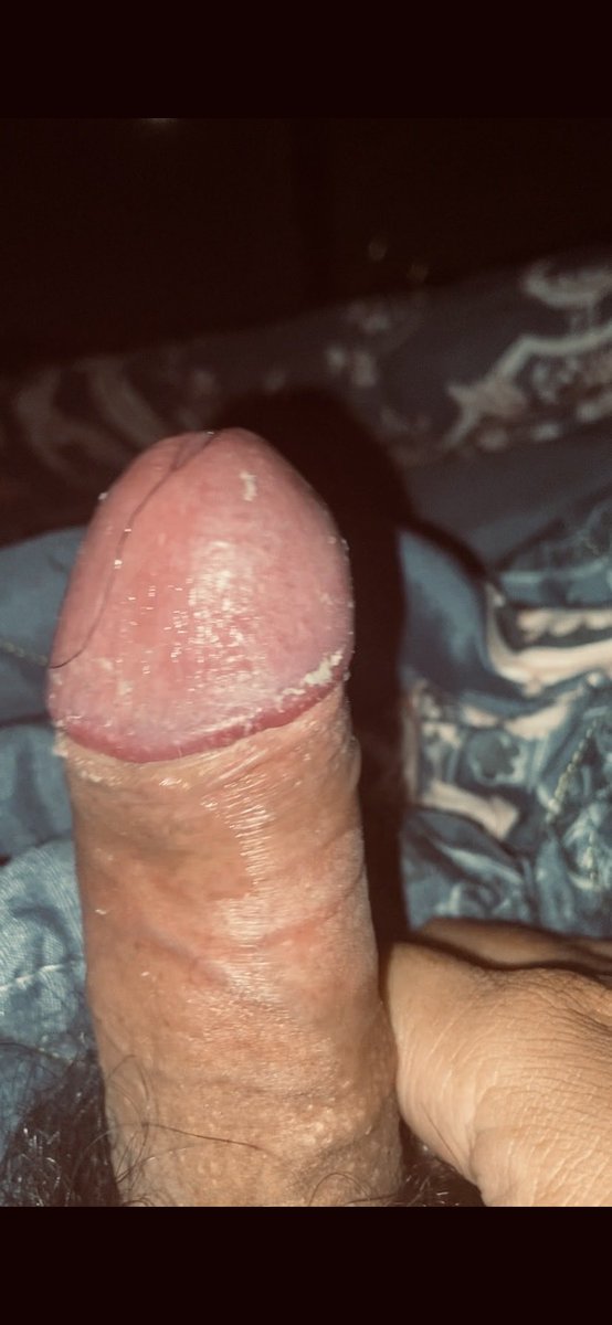 JJJASonnye's tweet photo. Càng hôi càng nứng 🧀🧀🧀 #smegma #cacbua #mancum #stinkdick https://t.co/s0ylYs1aA4