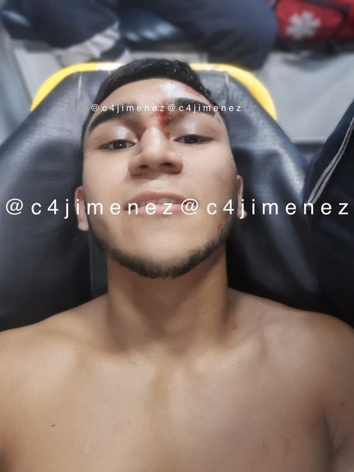 DETIENEN a UNA de LAS NOVIAS del DITHER de LA UNIÓN
Belina Michellle Zamudio
Dice q es comerciante 
Es una de las parejas del matón de La Unión q está preso en un penal federal.
Agentes de Inteligencia de <a href="/SSC_CDMX/">SSC CDMX</a> la detuvieron en 
<a href="/TuAlcaldiaGAM/">Alcaldía Gustavo A. Madero</a> 
Así acabó en <a href="/FiscaliaCDMX/">Fiscalía CDMX</a>