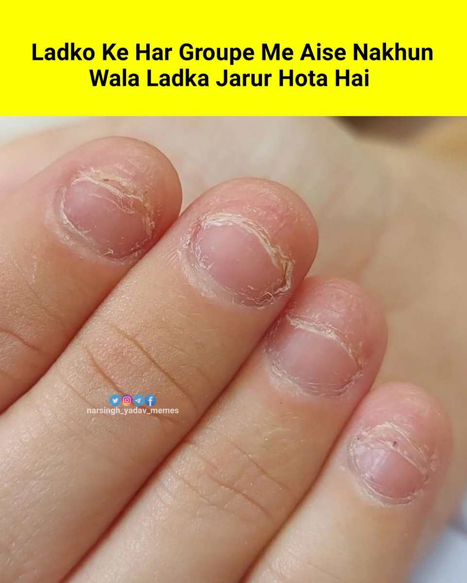 Narsingh_Y_Meme's tweet image. Baat to sahi hai 😆 

#GodMorningSunday