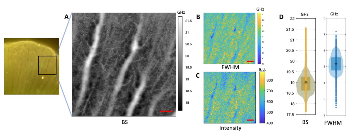 Première publication application microscopie Brillouin basée sur les VIPA en dentaire pour le LBN ! Bravo à Richard Younes, Alban Desoutter et à toute l'équipe !

sciencedirect.com/science/articl…