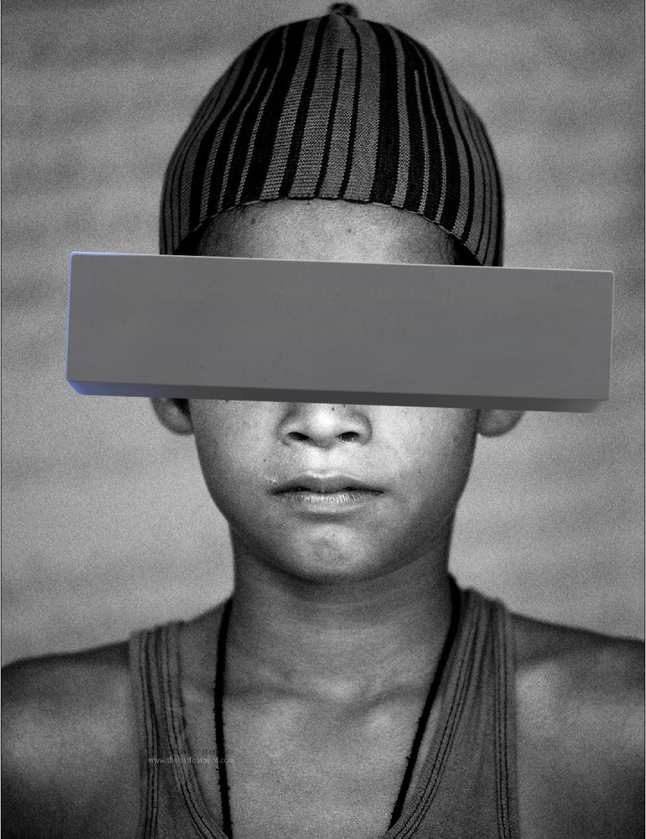 Muslim_ITCell's tweet photo. Muzaffarnagar, Uttar Pradesh; 13-Year-Old Muslim Boy Partially Loses Eyesight After Alleged Police Brutality, Father Threatened for Speaking Out.

In Muzaffarnagar, UP Police allegedly picked up a minor, tied his legs, and beat him till he lost sight in one eye, just because he used a mosque mic to announce a chicken discount after Navratri.

His father says the Inspector now threatens to jail him if he files a complaint. And yet, the same police say, “He already had an eye problem.” #IndianMuslims