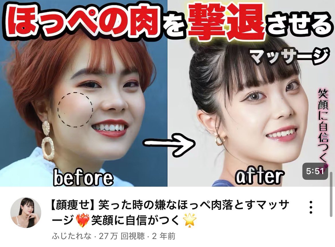 diet_nagomin's tweet photo. 横顔撮ると頬肉がポチャっと垂れてる人これやって。整形⁉️ってくらい横顔美人になる。 https://t.co/cKopD7LZGM