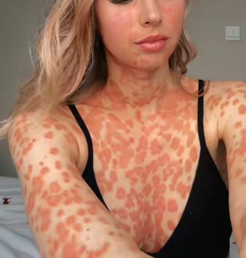 IhabFathiSulima's tweet photo. What is the diagnosis? https://t.co/hNrxr1KGt3