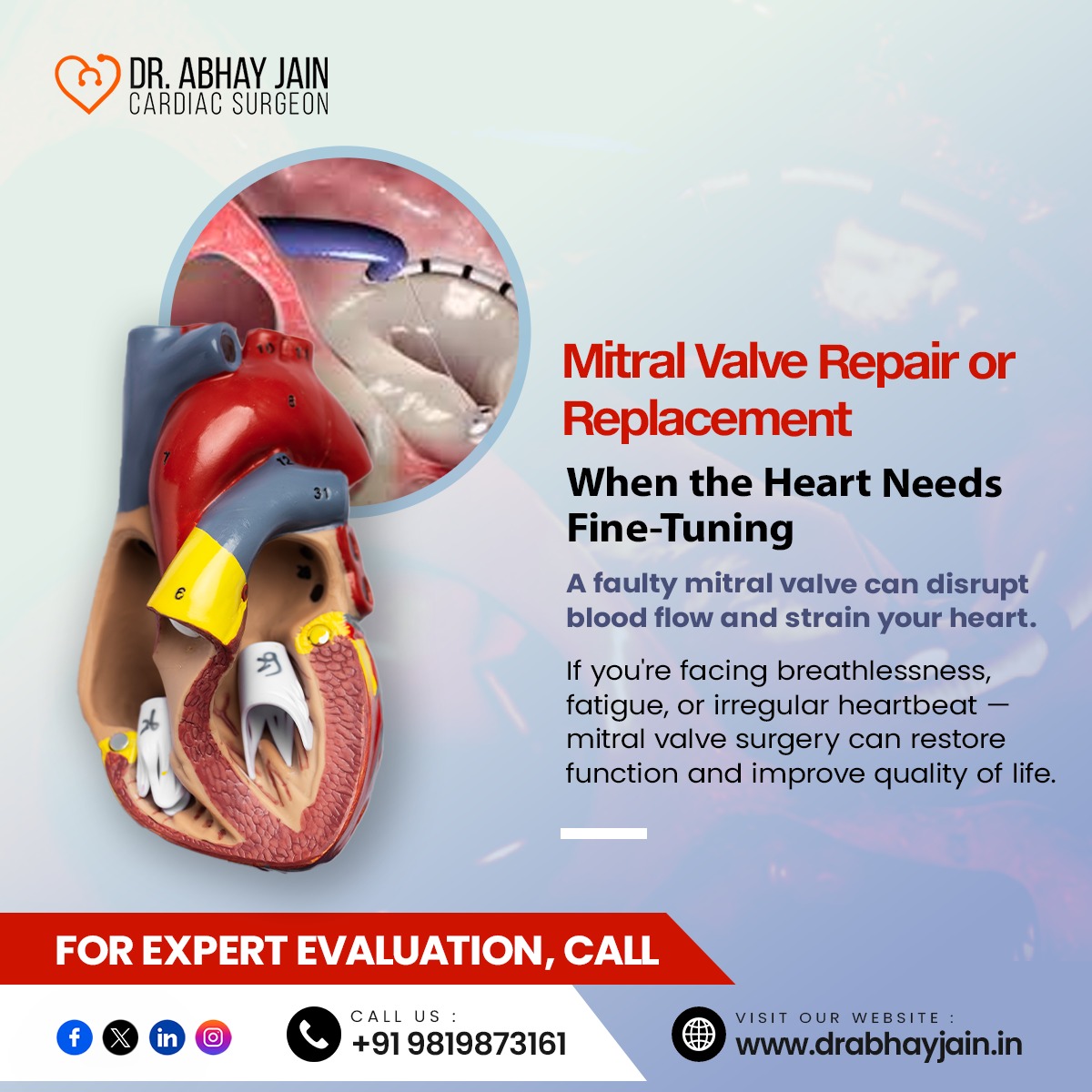 DrAbhayJaincvts's tweet photo. Mitral Valve Repair or Replacement๐ซ
โ When the Heart Needs Fine-Tuning
๐ Call Dr. Abhay Jain: +91 98198 73161
๐ Learn more: https://t.co/ijLxlyz0tV
#MitralValveSurgery #HeartCare #AbhayJain #HeartSurgeon #Mumbai #DrAbhayJain #MumbaiCardiacSurgeon #CardiacCare #HeartDisease https://t.co/1SG3Y5Pqc2