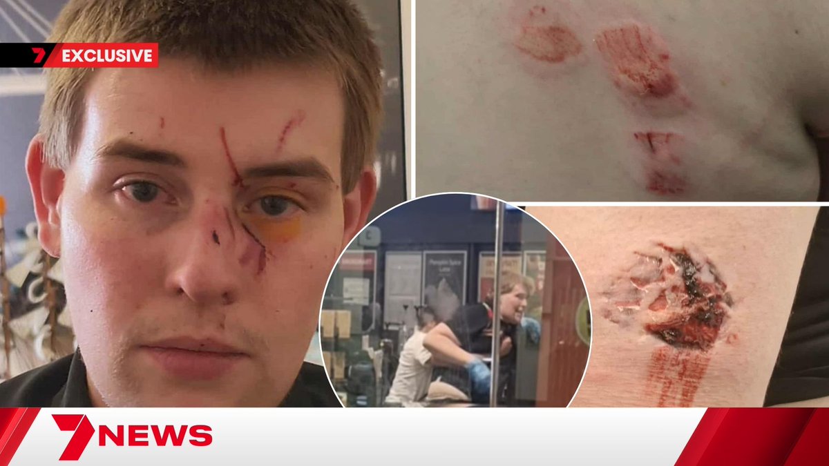 EXCLUSIVE: A Hungry Jack’s worker has told 7NEWS of the moment he was bitten and scratched by a customer inside a Port Augusta OTR. The vicious attack has left the innocent staff member in hospital and unable to work. A 38-year-old woman has been charged with a string of