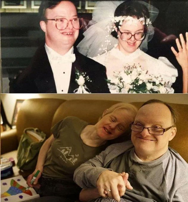 Couple with Down syndrome was told not to marry. 

And 25 years later...