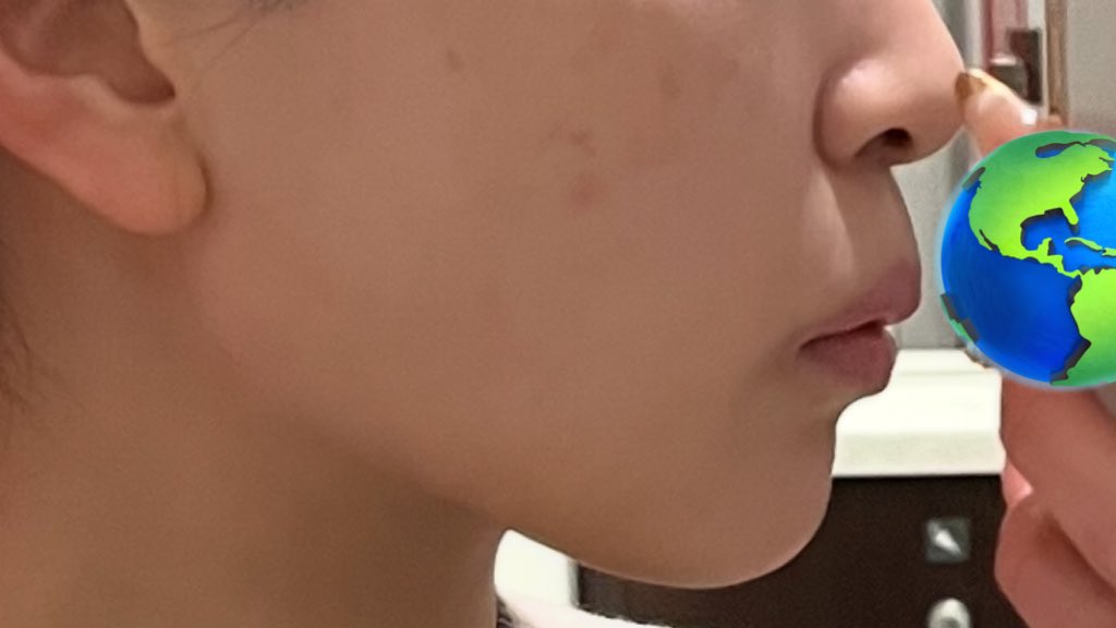 tofu0221's tweet photo. 歯列矯正、鼻整形をして良かった
（矯正は年内には装置取れるかな…🙌🏻） https://t.co/ls0PdlVwXk