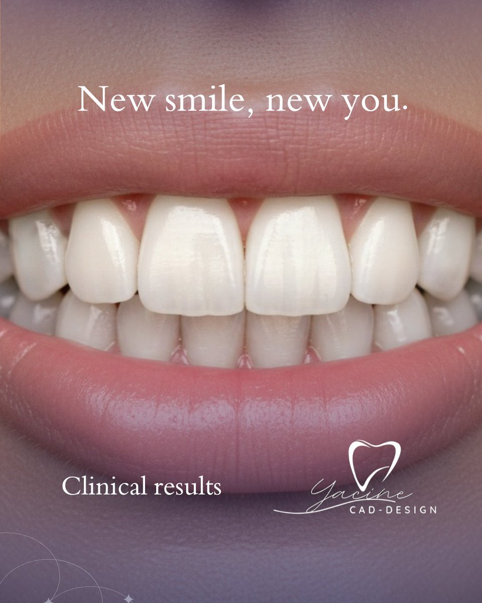 dentacine's tweet photo. Get a new smile 
#DentalHealth #smile 
#exocad #dentallab https://t.co/4IImK7hKXJ