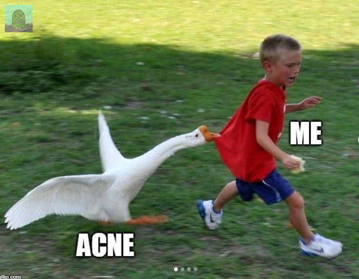 Tanyarl 💚 tweet media