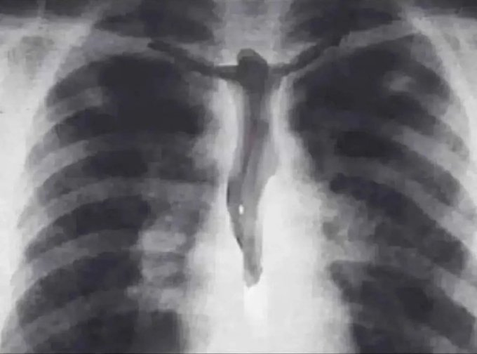 Jesus lives in us - Galatians 2:20.